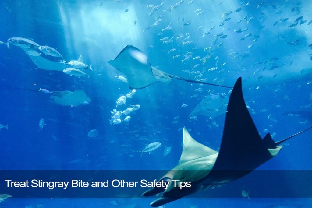 Treat Stingray Bite and Other Safety Tips